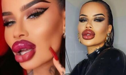 ‘I am addicted to filler, Botox’: 30-year-old OnlyFans star spends ₹53 lakh to look like ‘Barbie for life’