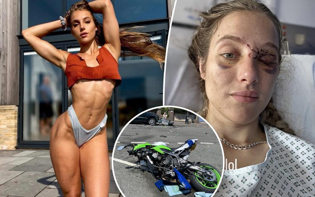 Death-defying neuroscientist turned OnlyFans model confronts life with memory loss — after brutal bike accident caused by a pigeon