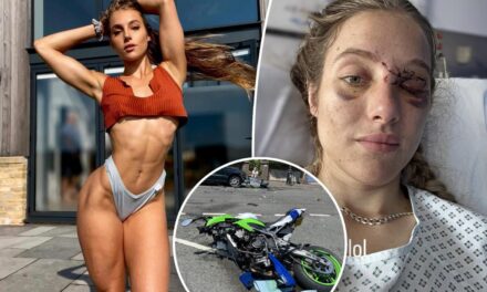 Death-defying neuroscientist turned OnlyFans model confronts life with memory loss — after brutal bike accident caused by a pigeon