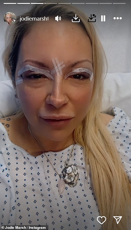 The bodybuilder recently underwent a blepharoplasty procedure to radically change her looks