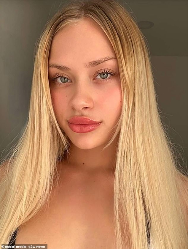 A Ukrainian OnlyFans model found seriously injured in Dubai on the side of the road is now feared to have been 'tortured by Russians'