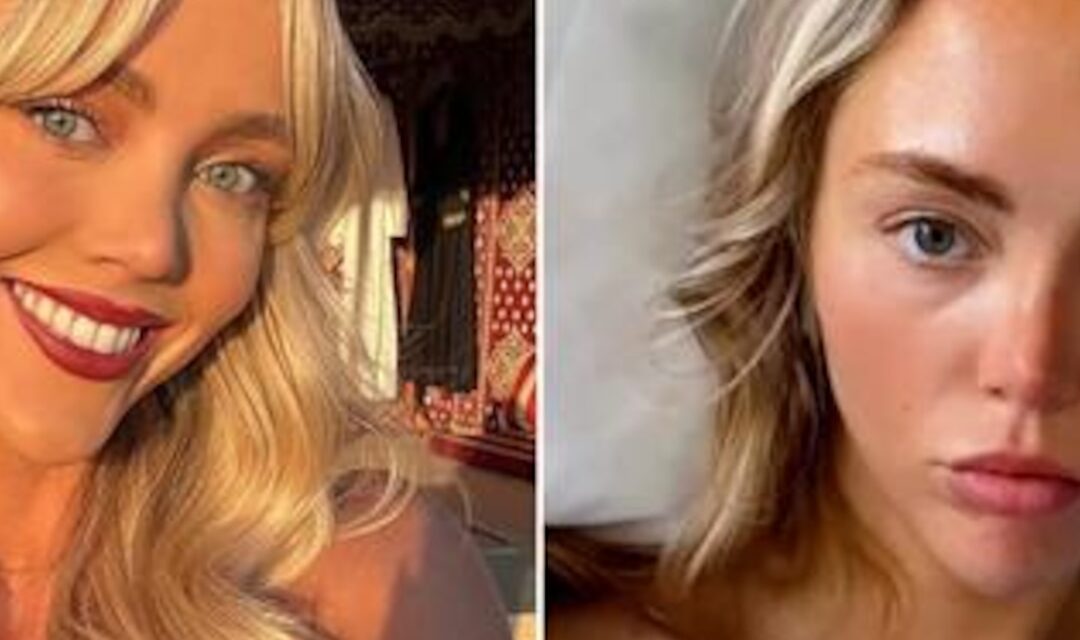 OnlyFans’ Annie Knight Shares Update From Hospital After Sex With 583 Men in 6 Hours